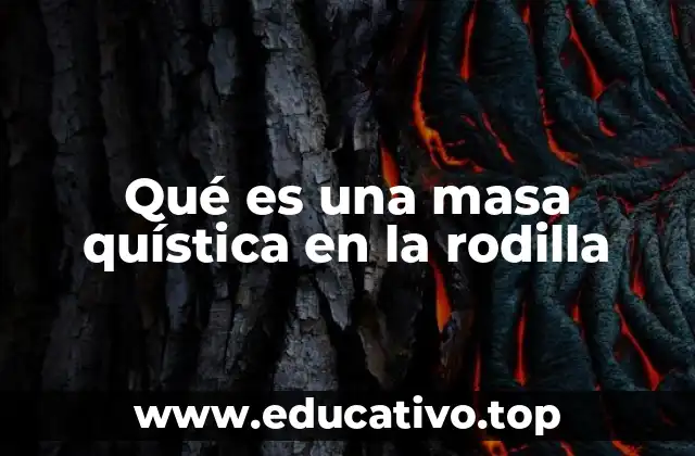 Qué es una masa quística en la rodilla