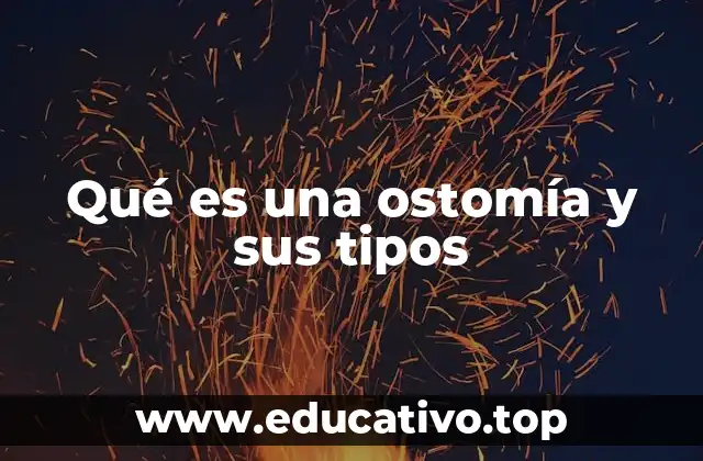 Qué es una ostomía y sus tipos