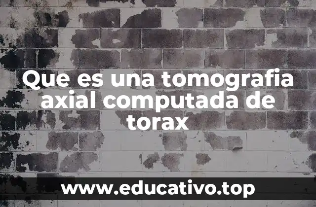 Que es una tomografia axial computada de torax