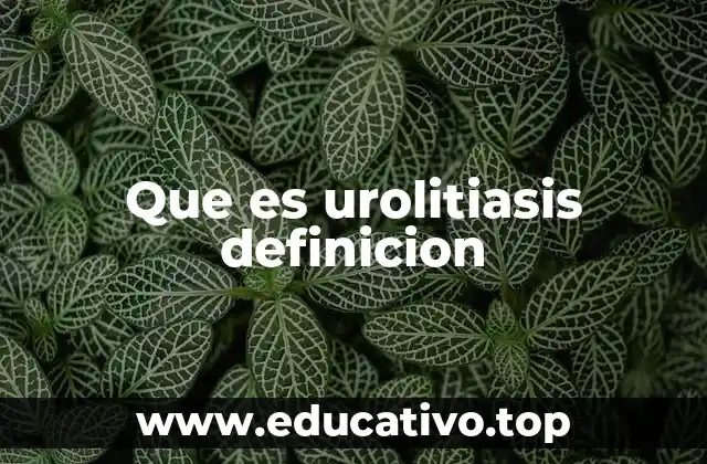 Que es urolitiasis definicion