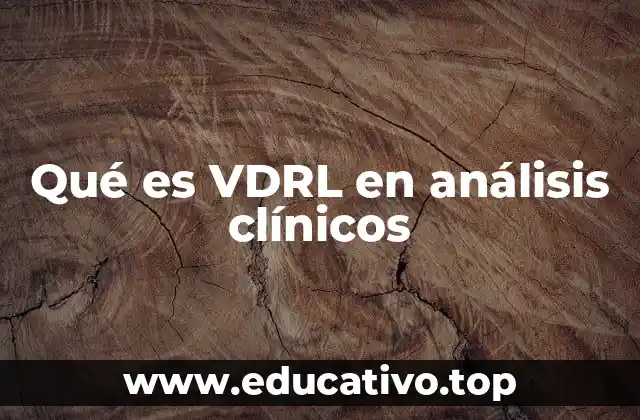 Qué es VDRL en análisis clínicos