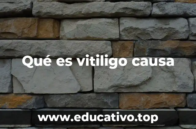 Factores que pueden desencadenar el vitiligo