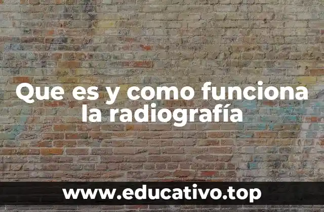 Que es y como funciona la radiografía