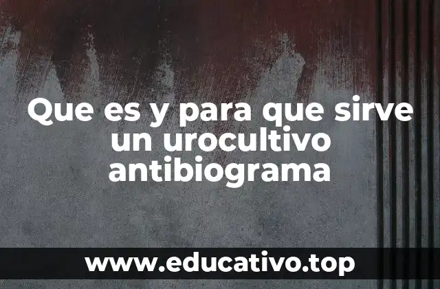 Que es y para que sirve un urocultivo antibiograma