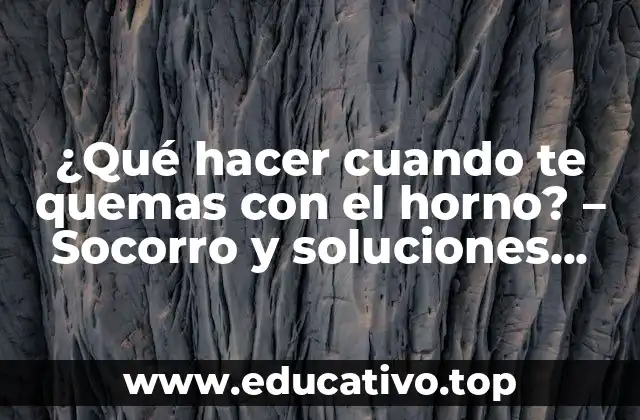 ¿Qué hacer cuando te quemas con el horno? – Socorro y soluciones para quemaduras leves