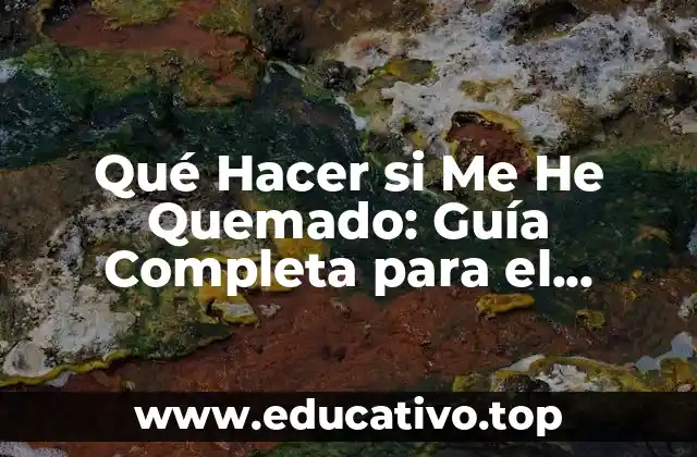 Qué Hacer si Me He Quemado: Guía Completa para el Cuidado y Tratamiento de Quemaduras