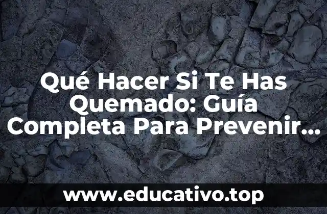 Qué Hacer Si Te Has Quemado: Guía Completa Para Prevenir Y Tratar Quemaduras