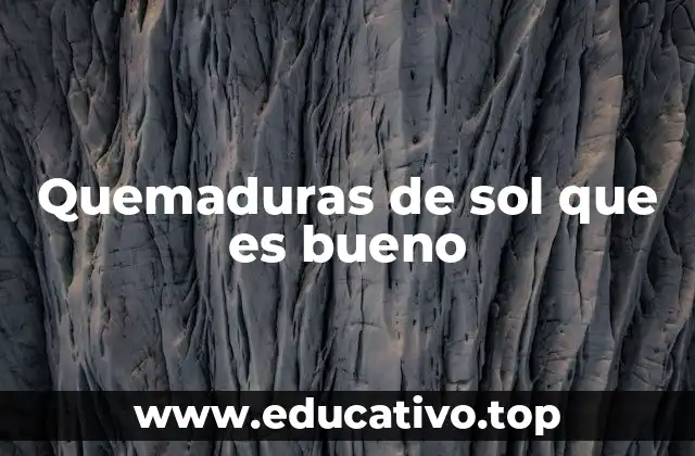 Quemaduras de sol que es bueno