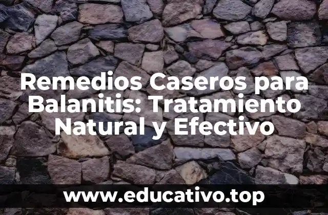 Remedios Caseros para Balanitis: Tratamiento Natural y Efectivo