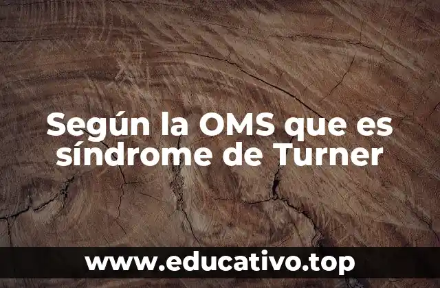Según la OMS que es síndrome de Turner