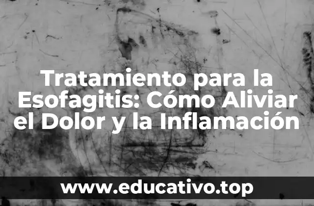 Tratamiento para la Esofagitis: Cómo Aliviar el Dolor y la Inflamación