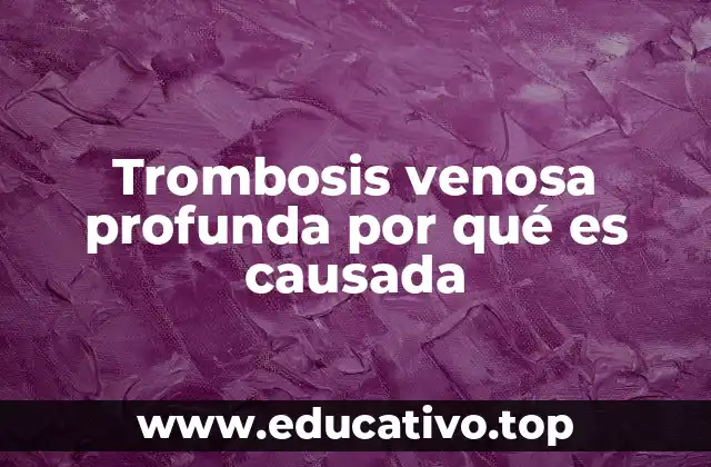Trombosis venosa profunda por qué es causada