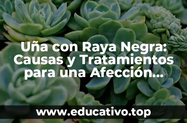 Uña con Raya Negra: Causas y Tratamientos para una Afección Común