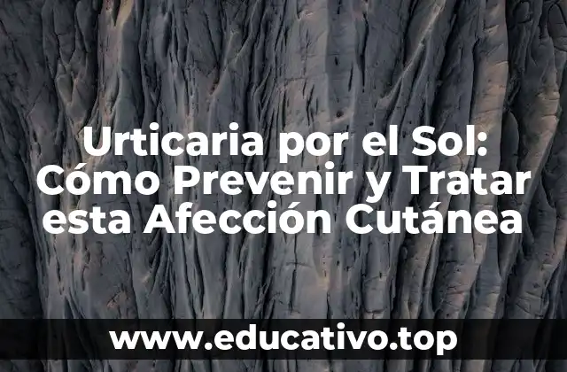 Urticaria por el Sol: Cómo Prevenir y Tratar esta Afección Cutánea