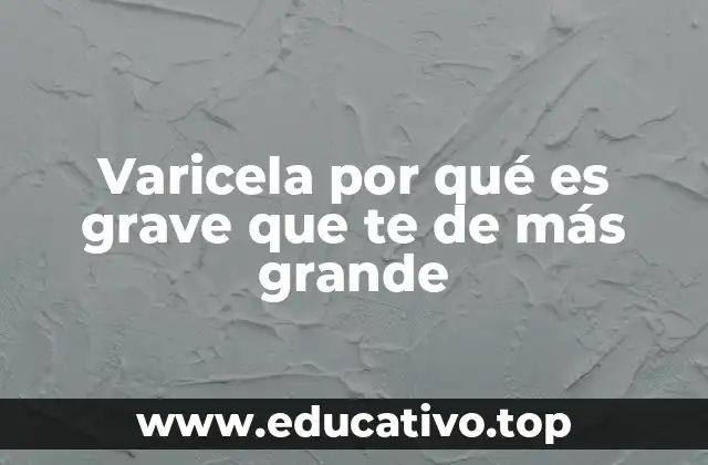 Varicela por qué es grave que te de más grande
