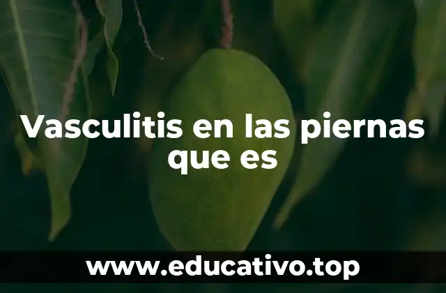 Vasculitis en las piernas que es