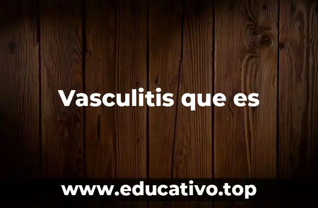 Vasculitis que es