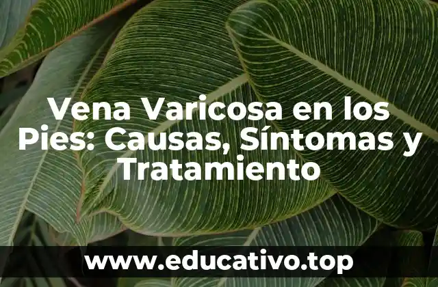 Vena Varicosa en los Pies: Causas, Síntomas y Tratamiento