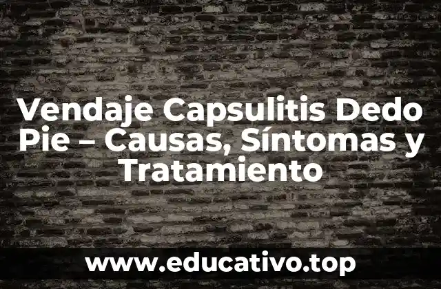 Vendaje Capsulitis Dedo Pie – Causas, Síntomas y Tratamiento