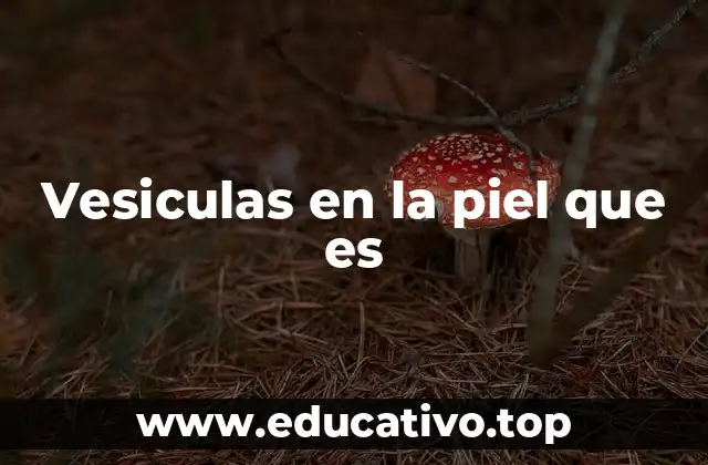 Vesiculas en la piel que es