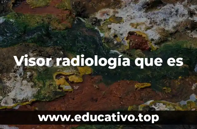 Visor radiología que es