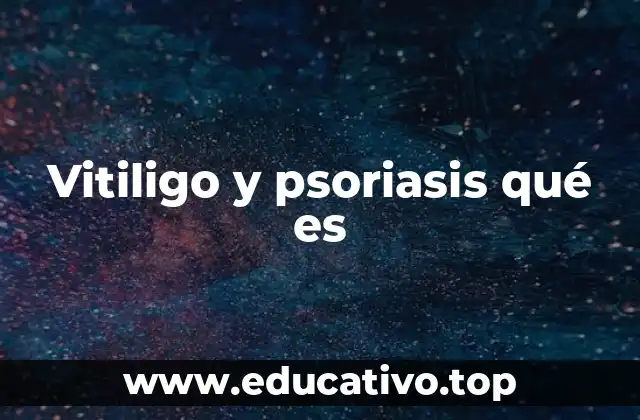 Vitiligo y psoriasis qué es