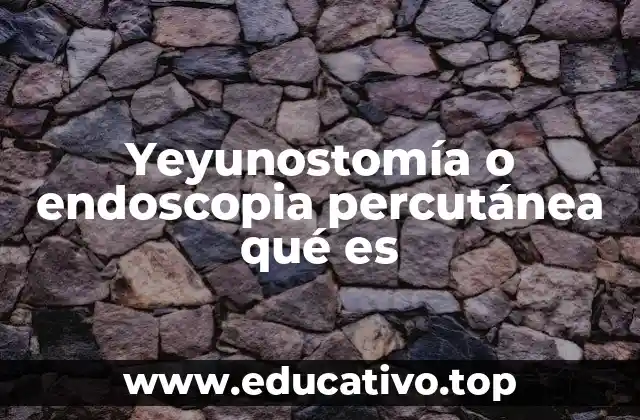 Yeyunostomía o endoscopia percutánea qué es